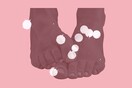5 λόγοι που εξηγούν τα αιωνίως «σκασμένα» πέλματα των ποδιών σας
