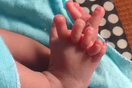 Μωρό στην Ινδία γεννήθηκε με 26 δάχτυλα και οι γονείς πιστεύουν πως είναι θεότητα 