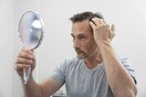 Δερματολογική Εταιρεία: Ένας στους τέσσερις άντρες χάνει μαλλιά πριν τα 20