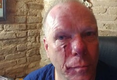 Σοκάρει το ηχητικό της επίθεσης κατά δημοσιογράφου στο συλλαλητήριο
