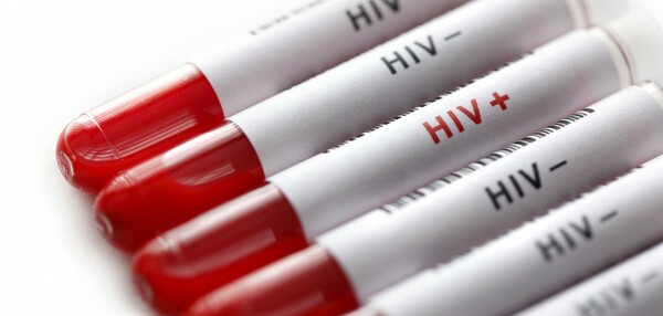 Ένα νέο χάπι μπορεί να απλοποιήσει τη θεραπεία για το AIDS