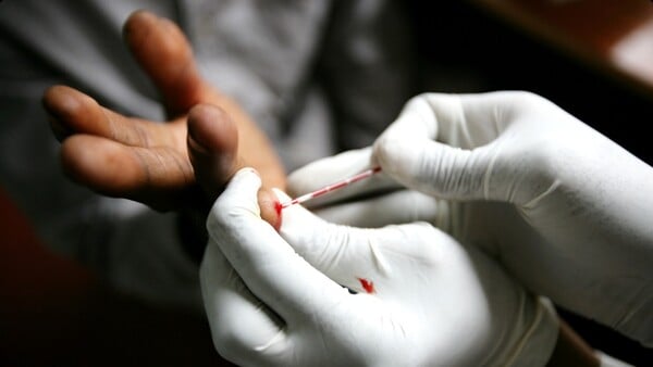 Το προσδόκιμο ζωής όσων έχουν προσβληθεί με τον ιό HIV του AIDS έχει αυξηθεί κατά 10 χρόνια