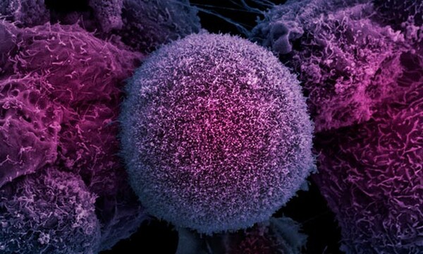 Η μάχη ενάντια στον καρκίνο πλησιάζει στο τέλος της και θα έχει μόνο νικητές