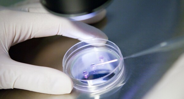 Νεαρή Γαλλίδα ζήτησε να εξαχθεί το σπέρμα του νεκρού συζύγου της για να υποβληθεί σε τεχνητή γονιμοποίηση