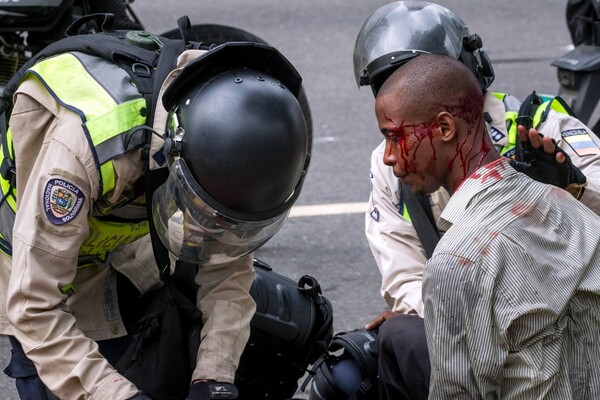 Βενεζουέλα: O γυμνός διαδηλωτής και η γυναίκα που έφραξε μόνη της το δρόμο στο στρατό