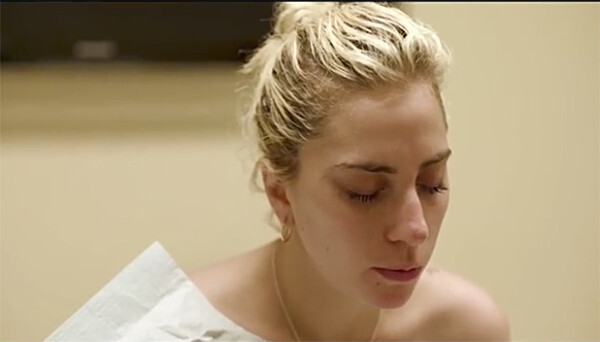 Η Lady Gaga αποκαλύπτει πως υποφέρει από Ινομυαλγία και μιλά γι' αυτό στο νέο ντοκιμαντέρ «Five Foot Two»