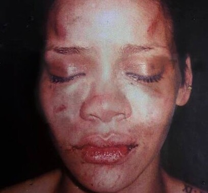 «Η φωτογραφία αυτή θα με στοιχειώνει για πάντα» - Ο Chris Brown μίλησε για τον ξυλοδαρμό της Rihanna