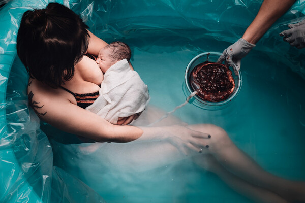 Τοκετός, λοχεία, θηλασμός: Το θαύμα της μητρότητας μέσα από 20 «ωμές» πλην εκπληκτικές φωτογραφίες