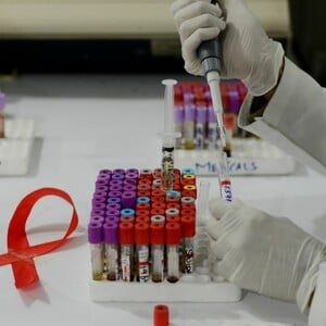 Νέο εμβόλιο κατά του HIV δίνει ελπίδες στους επιστήμονες - Τα πρώτα σημαντικά ευρήματα των δοκιμών