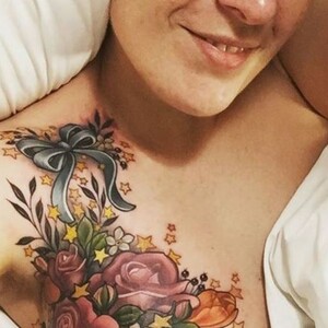 Πώς ο καρκίνος έκανε το στήθος αυτής της γυναίκας διάσημο στο Instagram